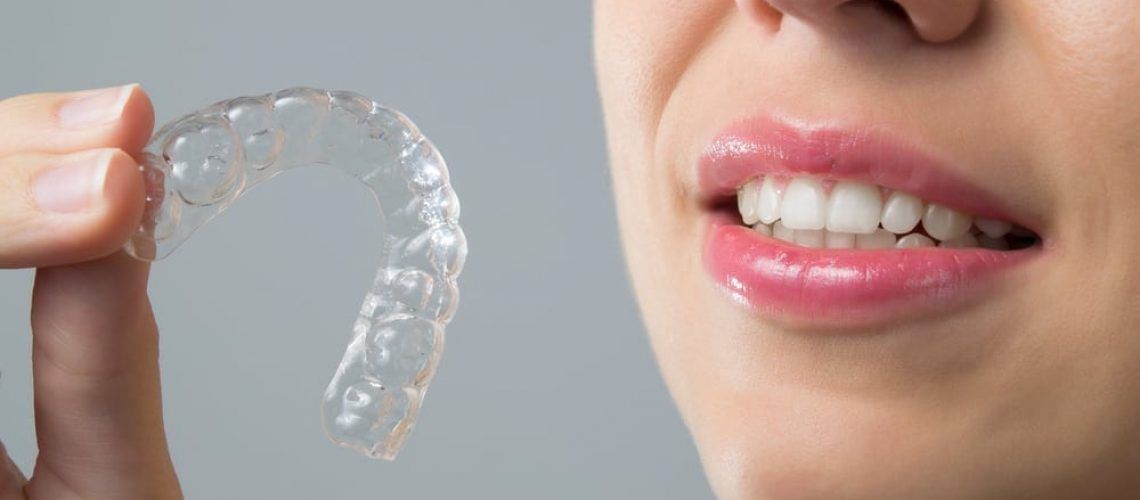 Invisalign Tedavisinde Plak Bakımı için İpuçları