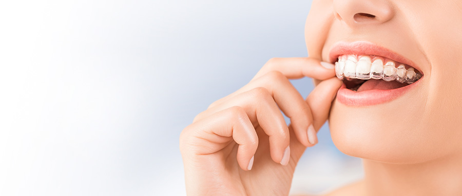 Invisalign Ne İşe Yarar?