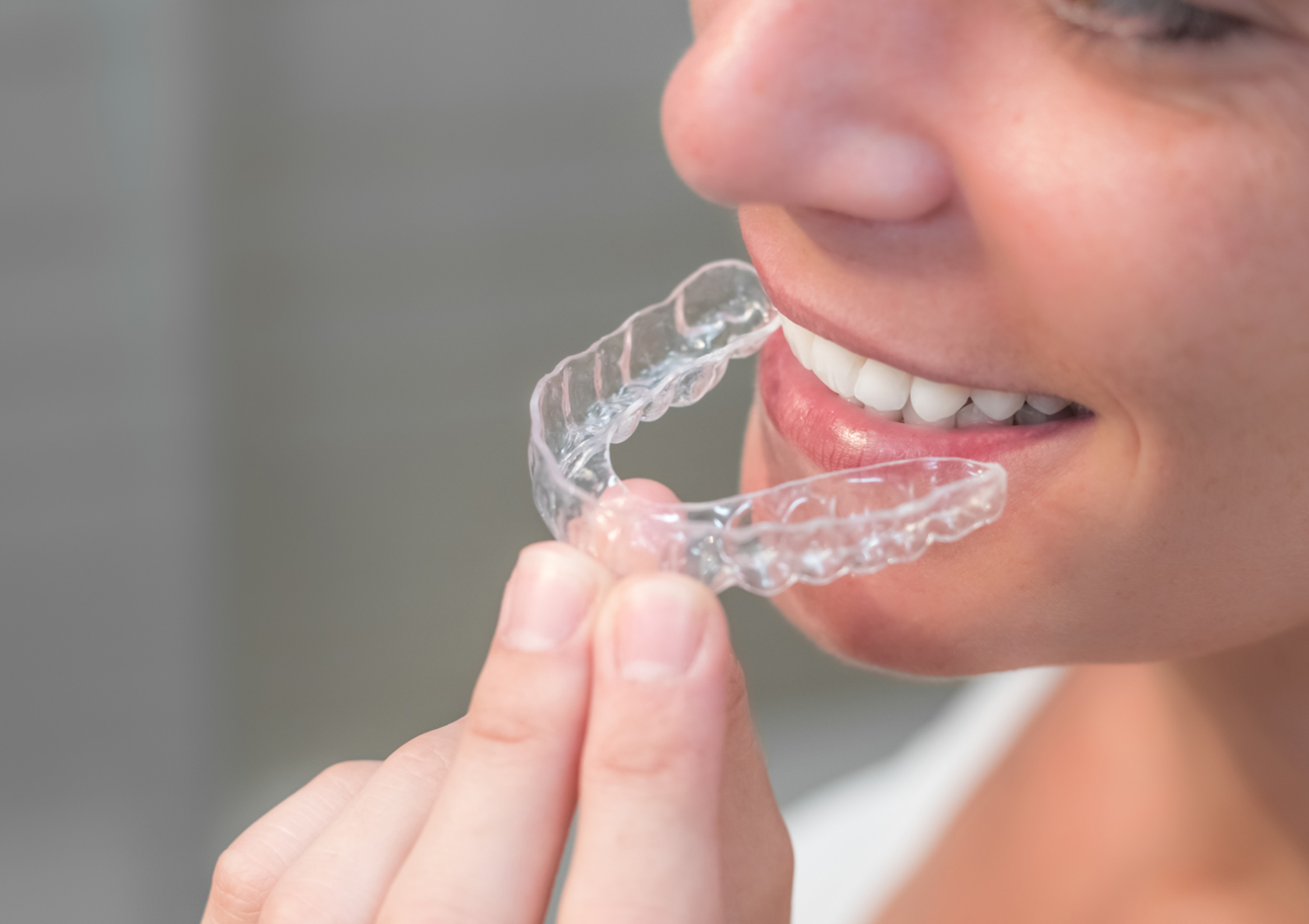 Invisalign Şeffaf Plakların Tedavi Süresi