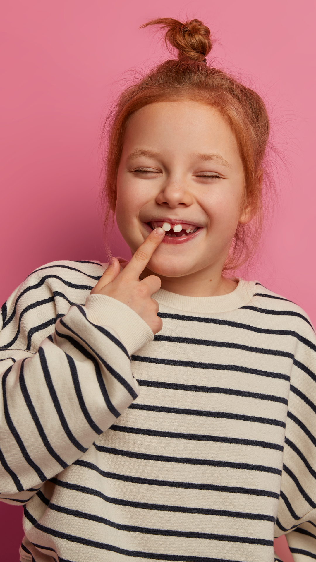 Invisalign Tedavi Süreci 6